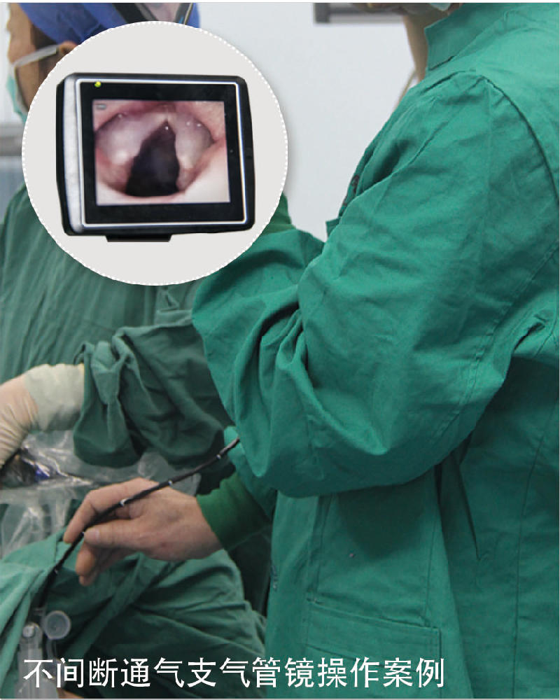 新型多功能喉罩不間斷通氣支氣管鏡操作案例